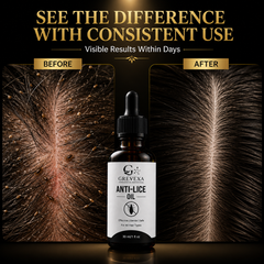 Grevexa Anti-Lice Hair Care Oil